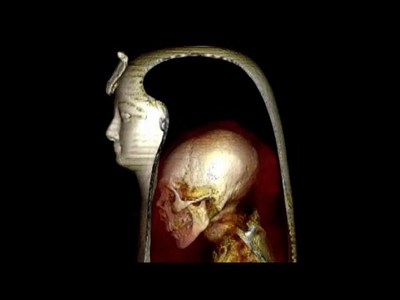 Secrets of a 3000-year-old mummy unwrapped using X-ray and 3D scans