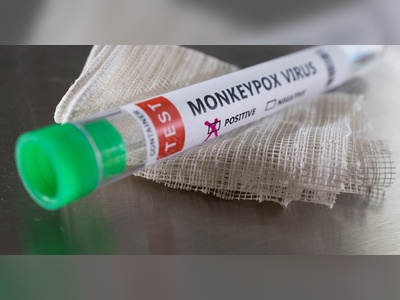 Vaccine business: British agencies secure funds to develop standard monkeypox tools