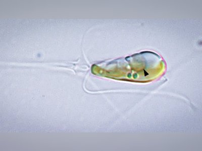 Scientists Witness Rare Evolutionary Event That Happens Once Every Billion Years: The Birth of a New Organism Through Cellular Ingestion